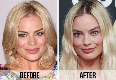 margot robbie buccal fat reddit  You will be trying to refill that volume in the future